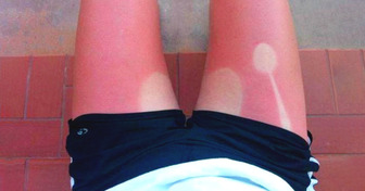 9 Menschen, die zu große Pechvögel waren, um ihren Urlaub genießen zu können