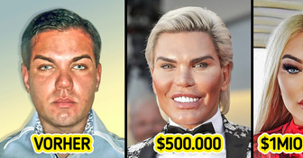 Ich habe 1 Million Dollar für Schönheitsoperationen ausgegeben, um wie eine Barbiepuppe auszusehen