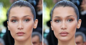 Wie 14 Promis ohne ihr einzigartiges Erkennungsmerkmal aussehen würden