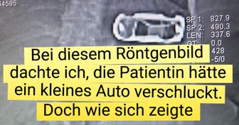 15+ Überraschungen, die von einem Röntgenbild aufgedeckt wurden