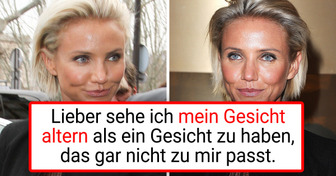 8 Prominente, die sich mal unters Messer gelegt haben und es danach bereuten