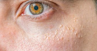 8 Anzeichen dafür, dass dein Gesicht schneller altert, als es sollte