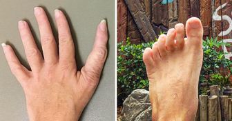 14 Menschen, die von der Natur eine Überraschung bekommen haben