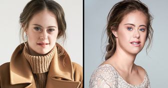 Ein Model mit Down-Syndrom beweist, dass du die einzige Person bist, die Schönheit für dich definieren kann
