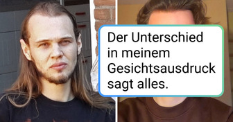 17 Menschen, die sich einem kosmetischen Eingriff unterzogen haben, was ihr Selbstwertgefühl radikal verändert hat