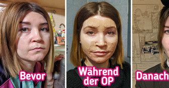 Diese 14 Frauen erzählen dir die ganze Wahrheit über ihre Schönheitsprozeduren