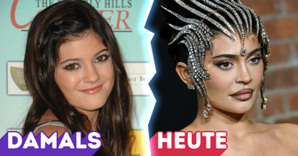 “Ich will nicht, dass meine Tochter das macht”, Kylie Jenner spricht über ihre Reue bezüglich Schönheitsoperationen