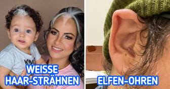 10 seltsame körperliche Merkmale, die nur manche Menschen besitzen