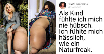 Ein aufstrebendes Model mit einem 45-Kilo-Bein akzeptiert ihre Einzigartigkeit und will der Welt zeigen, dass anders sein schön ist