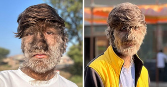 Der Junge, den man “Affe” nannte, und trotz allen Widrigkeiten zu vloggen begann