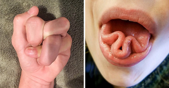 18 Fotos, die beweisen, dass der menschliche Körper ein wahres Wunderland ist