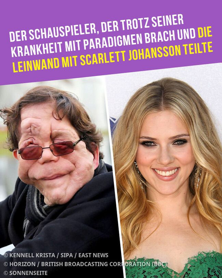 Der Schauspieler, der trotz seiner Krankheit mit Paradigmen brach und die Leinwand mit Scarlett Johansson teilte