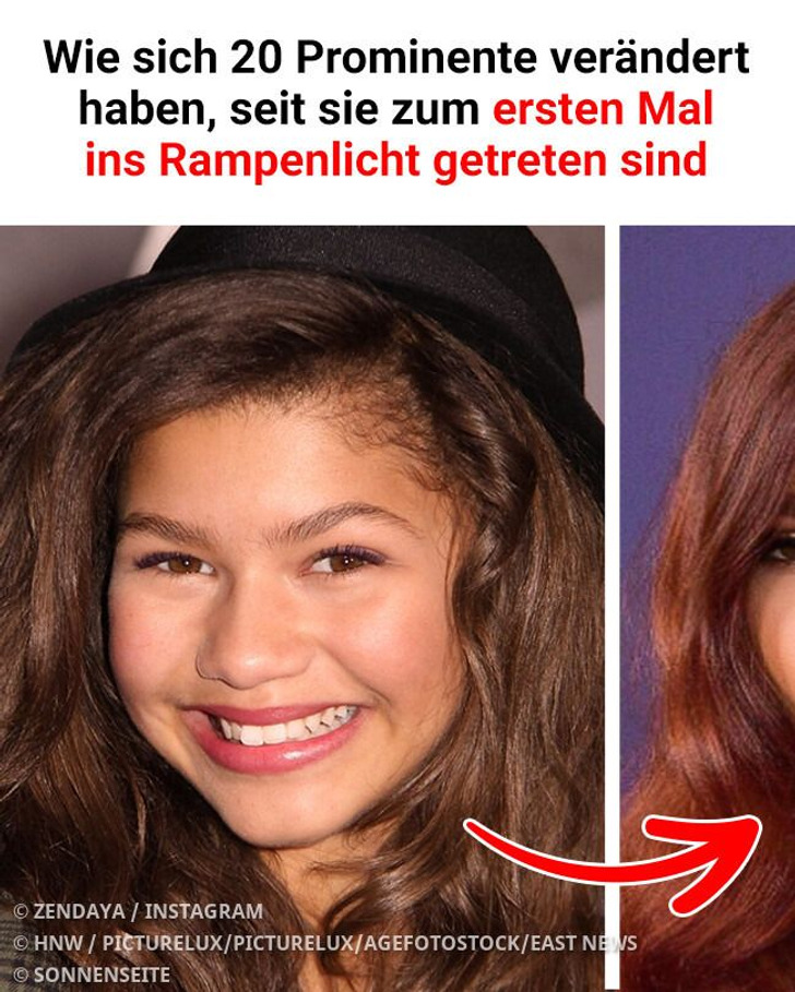Wie sich 20 Prominente verändert haben, seit sie zum ersten Mal ins Rampenlicht getreten sind