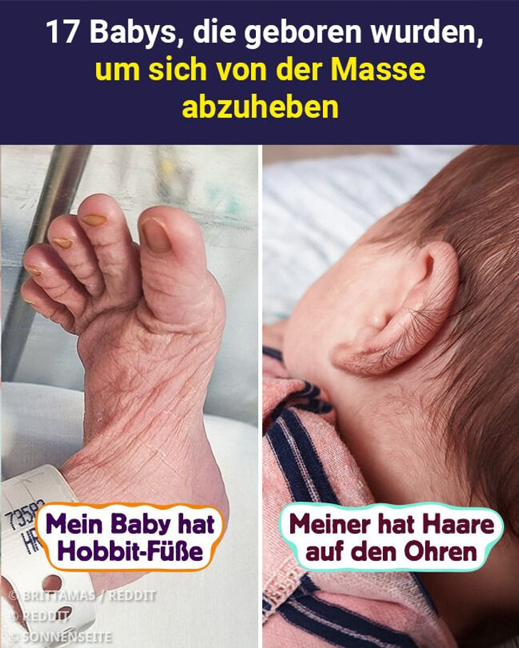 17 Babys, die geboren wurden, um sich von der Masse abzuheben