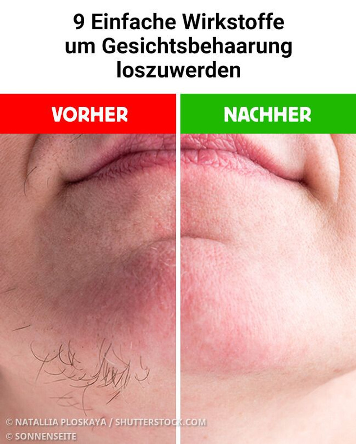9 Einfache Wirkstoffe um Gesichtsbehaarung loszuwerden