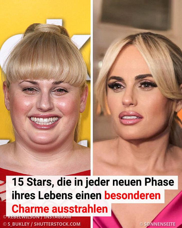 15 Stars, die in jeder neuen Phase ihres Lebens einen besonderen Charme ausstrahlen