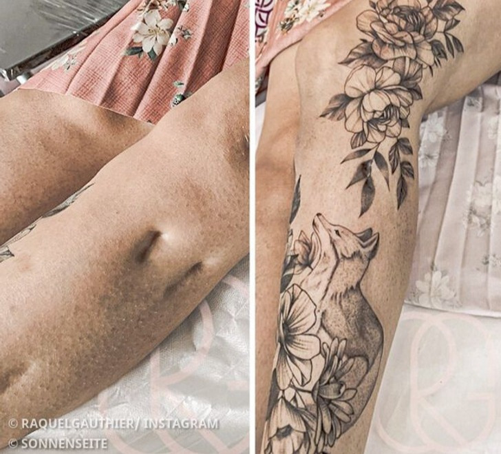 16 Menschen, die ihre Narben in Kunstwerke verwandelten