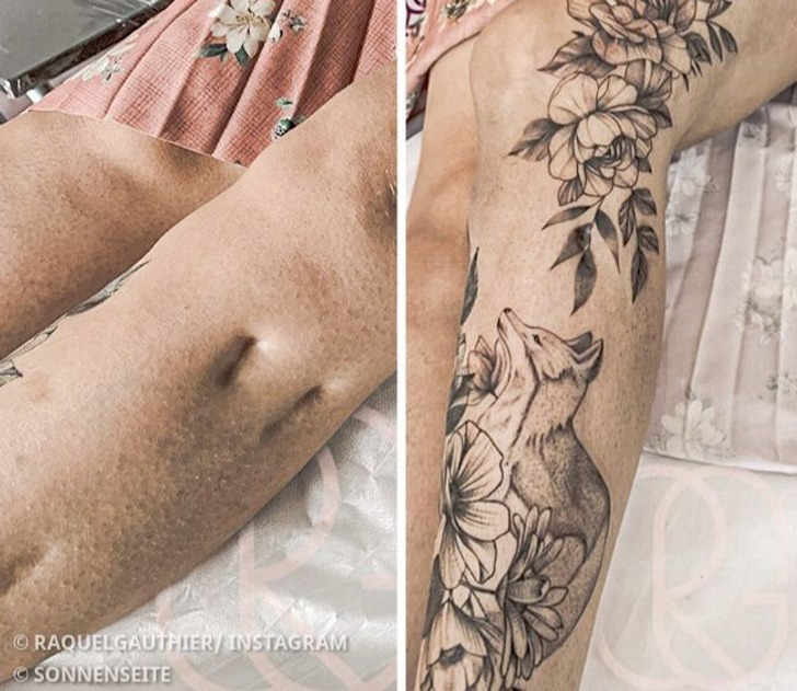 16 Menschen, die ihre Narben in Kunstwerke verwandelten