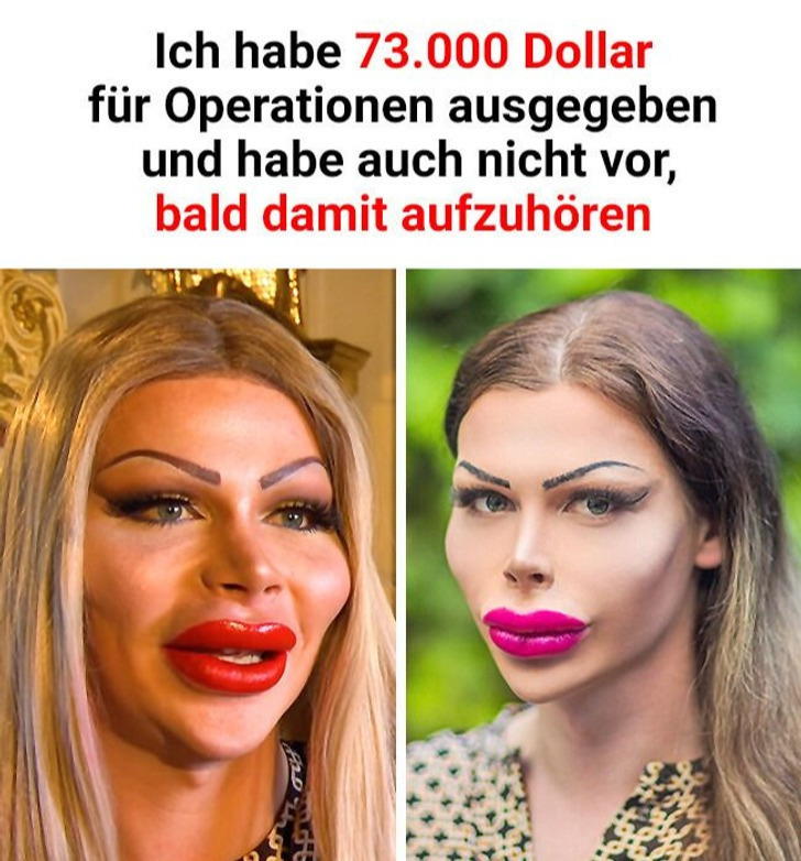 Ich habe 73.000 Dollar für Operationen ausgegeben und habe auch nicht vor, bald damit aufzuhören